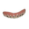 Dente com Aparelho Nerd Geek Dente com Aparelho Nerd Geek