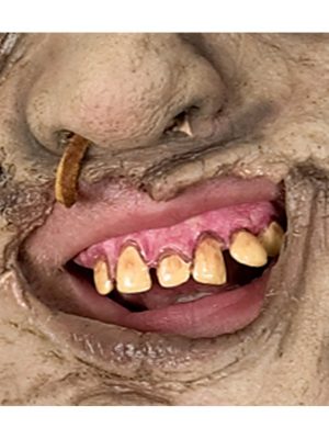 Dentes Leatherface Adulto Luxo Dentes Leatherface Adulto Luxo